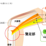 鵞足炎