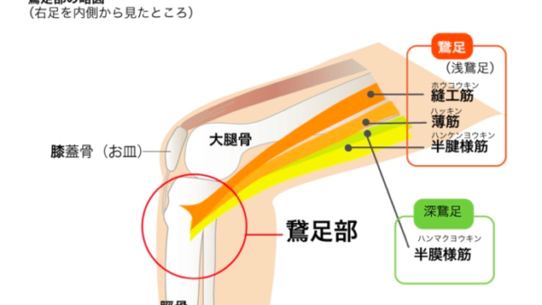 鵞足炎