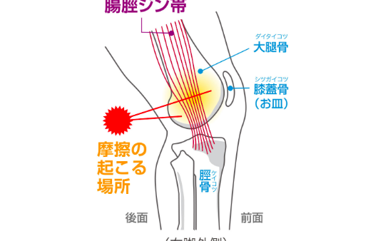 腸脛靭帯炎