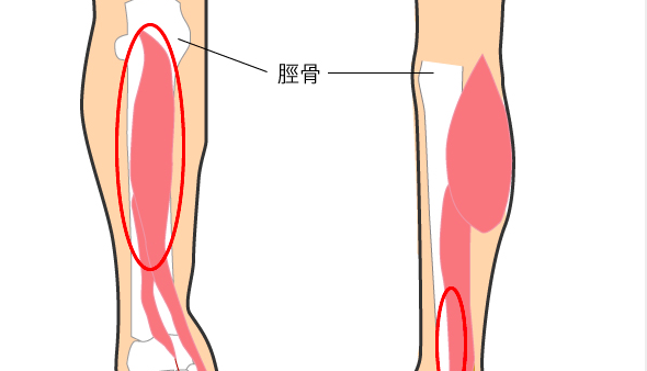 シンスプリント