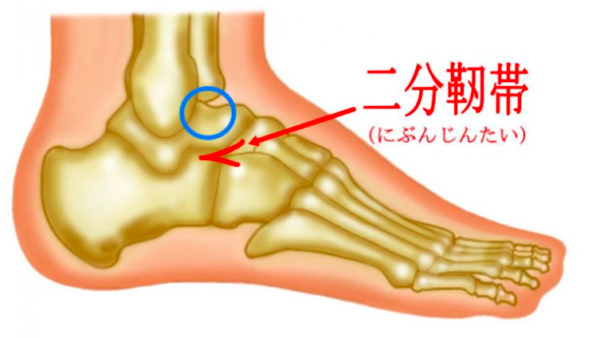 足関節二分靭帯損傷